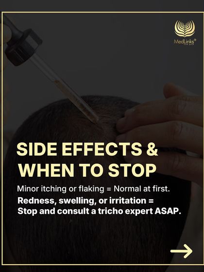 What about side effects? Minor itching or flaking can be normal at first. However, if you experience redness, swelling, or irritation, you should stop and consult a trichology expert immediately.