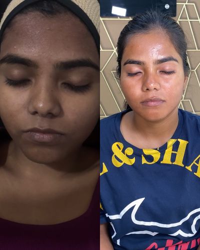 Advanced Aesthetic & Skin Treatments