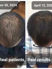 Hair & Scalp Treatments