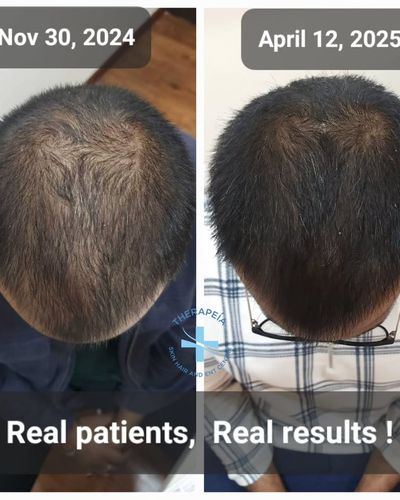 Hair & Scalp Treatments
