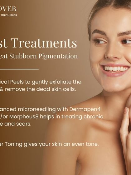 Here are some of the best treatments we offer for stubborn pigmentation. This includes medical peels for gentle exfoliation, advanced microneedling for chronic acne and scars, and laser toning for an even skin tone.