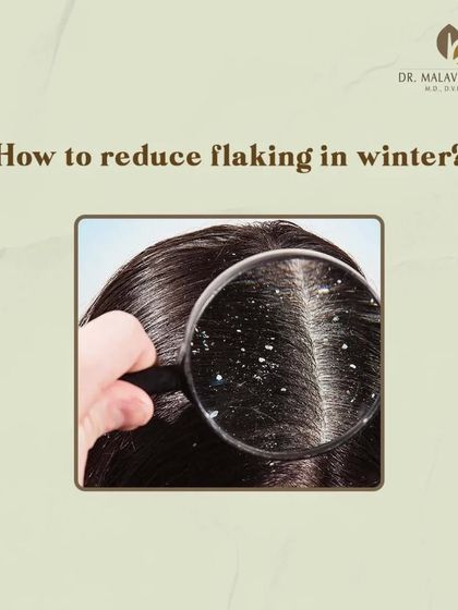 Scalp flaking is a common issue, especially during the dry winter months. Understanding how to manage and reduce this condition is key to maintaining scalp health and comfort.