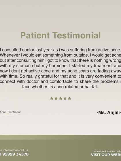 This testimonial from Ms. Anjali details her journey with hormonal acne. She explains how we identified the root cause and how her skin is now free of active acne, with scars fading. Her experience highlights the importance of a correct diagnosis.