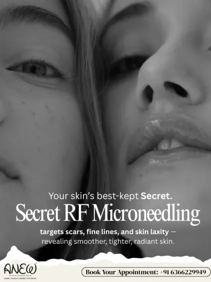 Secret RF Microneedling is one of our most advanced treatments for skin revitalization. It combines radiofrequency energy with microneedling to remodel collagen, effectively treating scars, fine lines, and skin laxity for smoother, tighter skin.