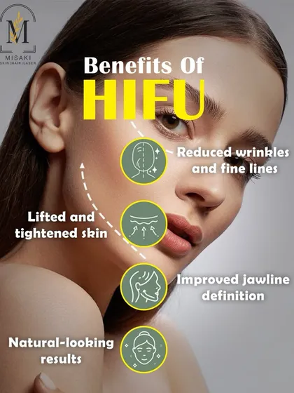 If you are looking for a non-surgical facelift, HIFU is the answer. This technology uses focused ultrasound to lift and tighten sagging skin, define the jawline, and reduce wrinkles, helping you look naturally younger with no downtime.