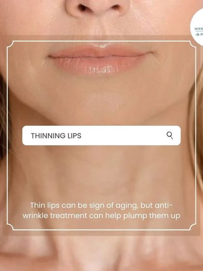 Thinning lips can be a sign of aging as collagen levels decline. Anti-wrinkle treatments and fillers can help plump them up, restoring a fuller, more youthful shape.