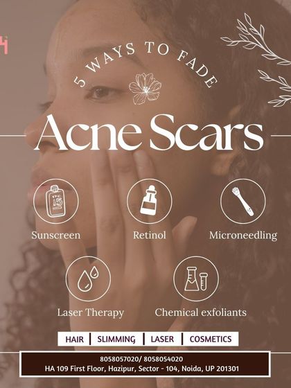 Here are five effective ways to fade acne scars. Our clinical treatments, including microneedling, laser therapy, and chemical exfoliants, offer powerful solutions alongside daily care like sunscreen and retinol.