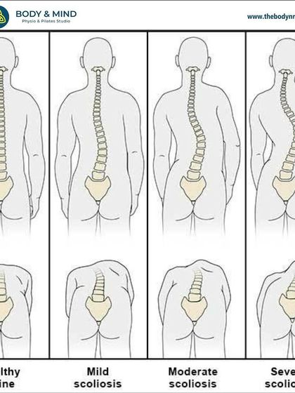 Body & Mind PhysioPilates Studio - Physical Therapy & Rehabilitation Back & Spine Health photo 20