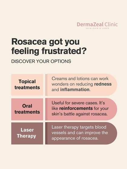 Feeling frustrated by Rosacea? This graphic outlines your options, which can include topical creams, oral treatments for severe cases, and laser therapy to target blood vessels and reduce redness.