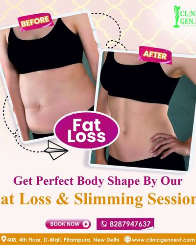 Non-Surgical Fat Reduction