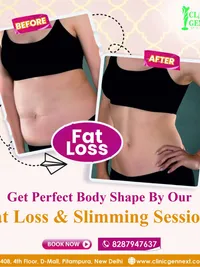 Non-Surgical Fat Reduction