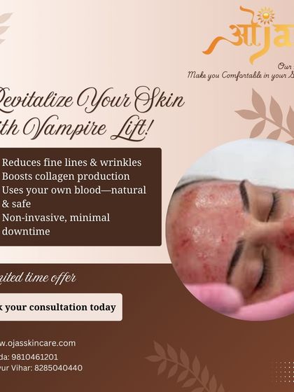 The Vampire Lift, or PRP treatment, is a natural way to revitalize your skin. It uses your own blood's healing properties to reduce fine lines and boost collagen production. It is a safe, non-invasive procedure with minimal downtime.