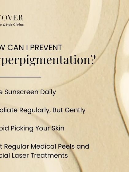 How can you prevent hyperpigmentation? Use sunscreen daily, exfoliate gently, avoid picking your skin, and get regular medical peels or laser treatments to maintain clear, even-toned skin.