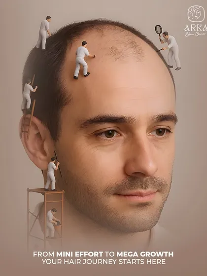 Your hair journey starts here. This creative visual represents the detailed, meticulous work our team puts into every hair transplant procedure, ensuring mega growth from a mini effort on your part.