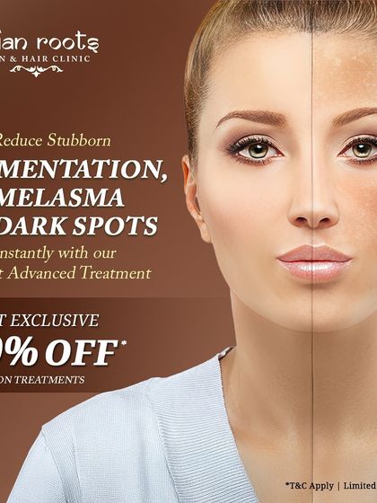 This graphic shows the transformative power of my advanced treatments for pigmentation, melasma, and dark spots. I offer exclusive discounts to make these effective solutions more accessible to my clients.