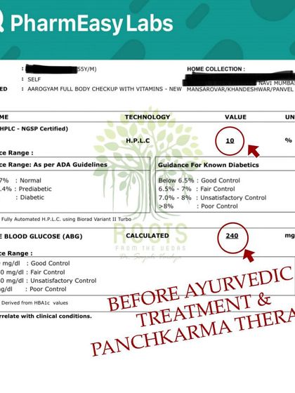 Before: This patient's lab report shows a dangerously high HbA1c of 10% and an average blood glucose of 240 mg/dl, indicating poor diabetic control.
