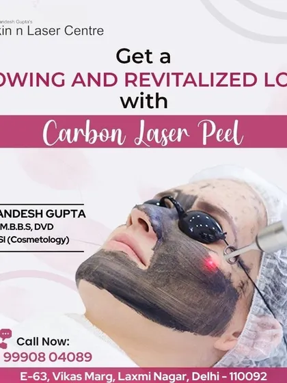 A Carbon Laser Peel, also known as a Hollywood Peel, is a great way to get a revitalized look. It exfoliates the skin, reduces pore size, and gives an instant glow.