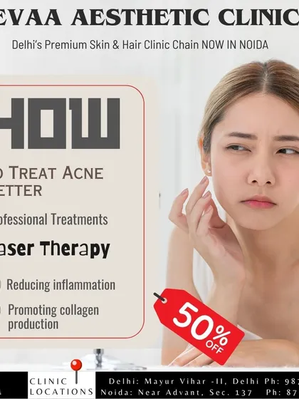 Learn how to treat acne better with professional laser therapy, which reduces inflammation and promotes collagen. This service is featured with a 50% off promotion.