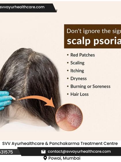 Scalp psoriasis can be particularly distressing, causing red patches, scaling, itching, and even hair loss. It is crucial not to ignore these signs. I offer targeted Ayurvedic treatments to soothe the scalp and manage this condition.