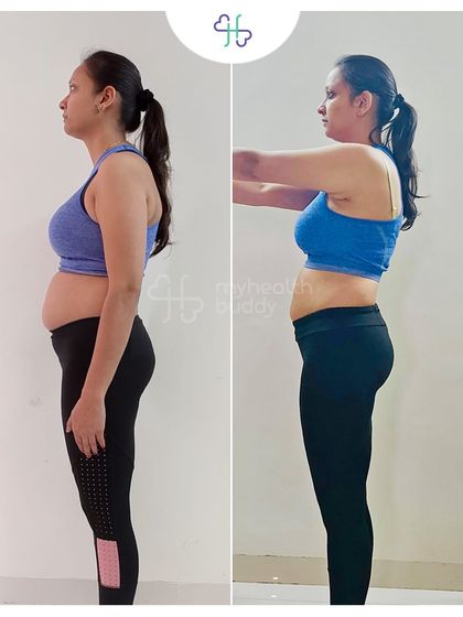 A 3 kg weight loss over 6 months, but a huge gain in strength and confidence. This client learned to push beyond her limits safely, celebrating every small victory along the way.