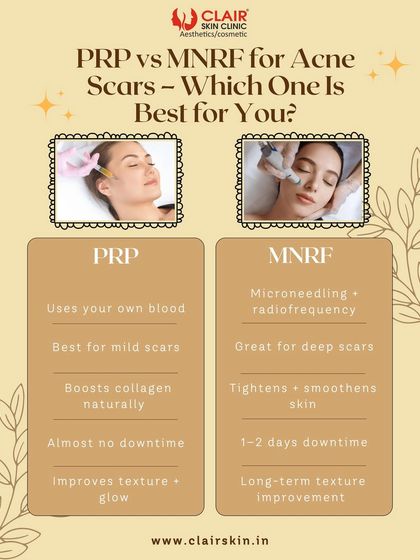 PRP vs. MNRF for acne scars. This guide helps you understand the difference. PRP is great for mild scars with no downtime, while MNRF is better for deep scars, offering significant long-term texture improvement.