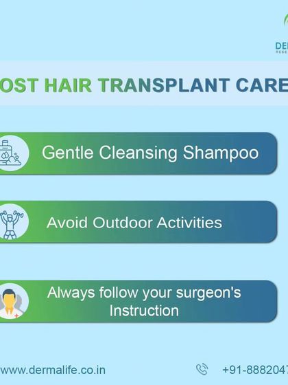 A simple guide to post-hair transplant care: use a gentle shampoo, avoid strenuous outdoor activities initially, and always follow your surgeon's instructions.