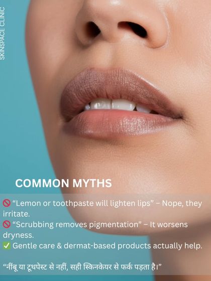 This graphic debunks common myths about treating dark lips. DIY remedies like lemon or toothpaste can cause irritation, while harsh scrubbing can worsen dryness. Gentle, dermatologist-recommended care is what truly helps.