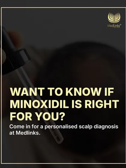 Want to know if Minoxidil is the right choice for you? The best way to find out is to come in for a personalized scalp diagnosis.