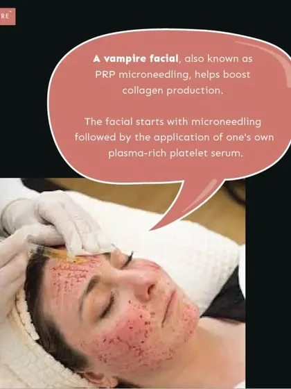 A closer look at the PRP microneedling process. While it may look intense, the procedure is performed carefully in a sterile clinical environment to ensure safety and maximize results for smoother, healthier skin.