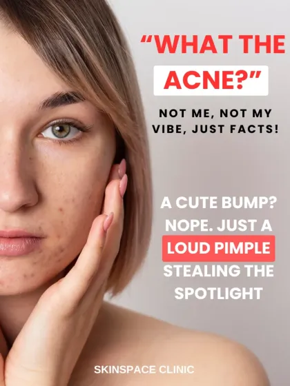 Acne is not just a teenage problem or a simple spot, it is a medical condition that I treat by getting to the root cause. Whether it is hormonal, stress related, or lifestyle induced, a proper diagnosis is the first step to achieving clear skin and preventing scars.