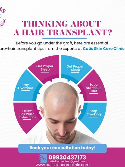 An essential guide for anyone considering a hair transplant. This infographic outlines key pre-procedure tips from our experts, including staying hydrated, eating a nutritious diet, and stopping smoking to ensure the best possible outcome.
