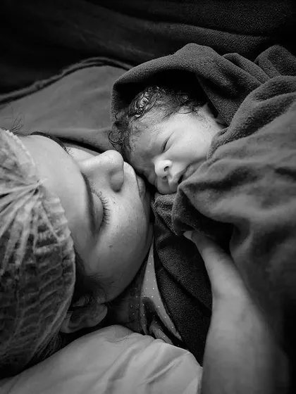 The quiet moments after delivery are just as profound. Here, a mother in a surgical cap holds her newborn nose-to-nose, a serene and intimate portrait that speaks volumes about the immediate bond between them.