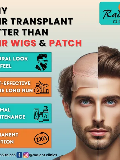 Many people consider hair wigs or patches, but a hair transplant offers a permanent solution that looks and feels natural, is cost-effective in the long run, and requires minimal maintenance.