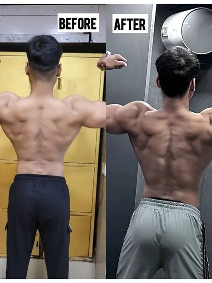 The back view of the same 6kg gain. You can see the added density and width in the lats and shoulders. We achieved this with zero unwanted fat gain or water retention, just pure muscle growth.