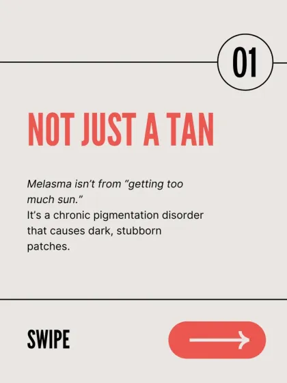 Melasma is a chronic pigmentation disorder that causes dark, stubborn patches, and it's not just from getting too much sun. It requires a different approach than treating a simple tan.