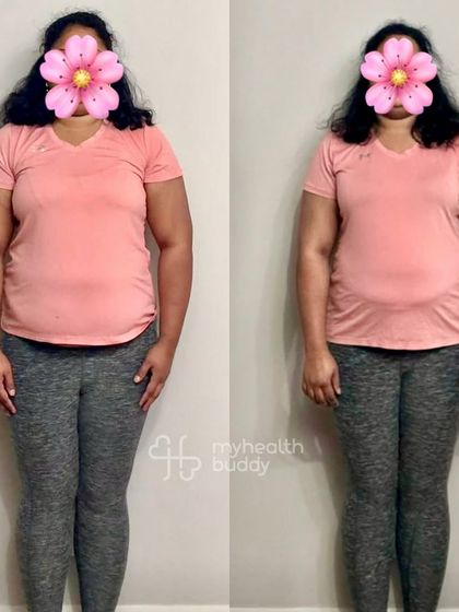 Starting at 98 kgs, this client lost 5 kgs in 3 months while living overseas with a hectic schedule. Even after twisting her ankle, we focused on ankle-strengthening exercises and she recovered stronger than before.