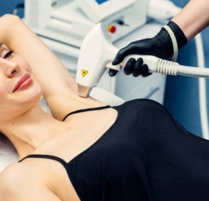 A patient comfortably undergoing underarm laser hair removal. The procedure is quick, and with the advanced technology I use, it is also virtually painless, making it a preferred choice for sensitive areas.