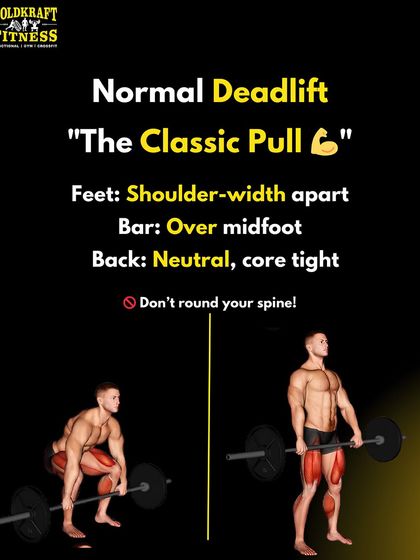 The Normal Deadlift is the classic pull. This infographic breaks down the form: feet shoulder-width apart, bar over midfoot, and a neutral spine to avoid injury.