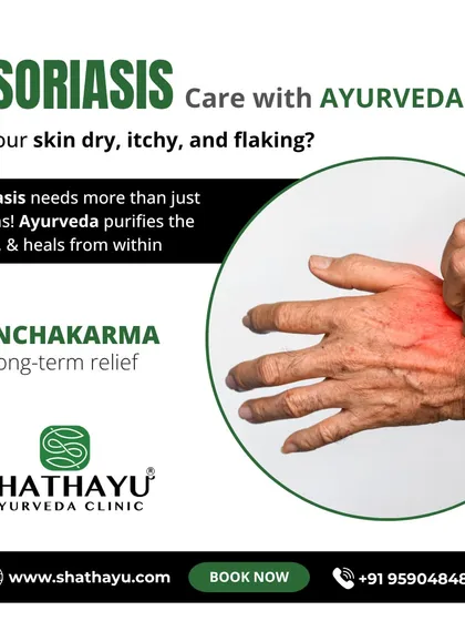For chronic conditions like Psoriasis, topical creams are not enough. Our approach involves purifying the blood and healing from within, using comprehensive treatments like Panchakarma to provide long-term relief from dry, itchy, and flaking skin.