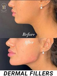 Cosmetic Injectables