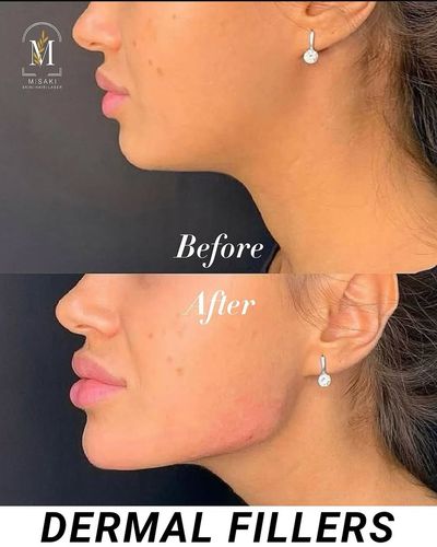 Cosmetic Injectables