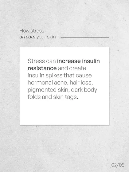 It is medically established that chronic stress impacts your entire body, including your hair and skin. Stress can increase insulin resistance, leading to hormonal imbalances that may cause hair loss, acne, and pigmentation.