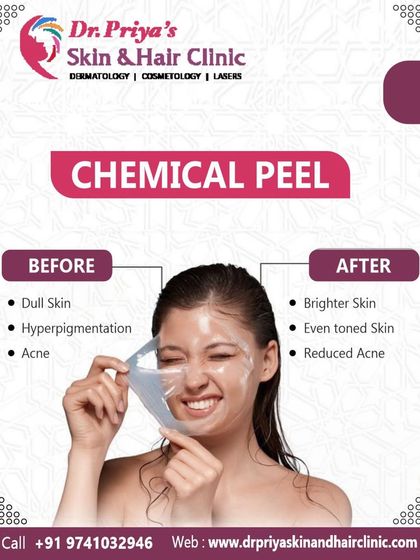 Priya J Talageri - Anti-Aging & Skin Tightening Chemical Peels & Advanced Facials photo 3