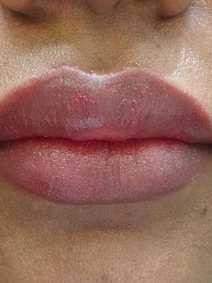 Here is a close-up of the final result of a lip neutralization. The color is even and the lips look healthy and hydrated, completely correcting the previous pigmentation.