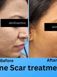 Aesthetic Dermatology