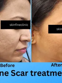 Aesthetic Dermatology