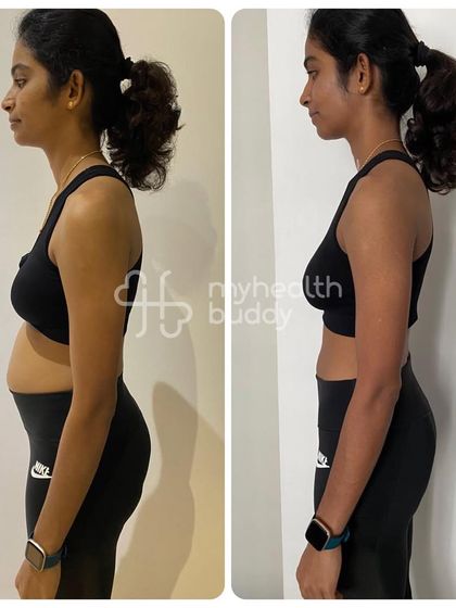 Side view of Logeswary's transformation, showing a significant reduction in belly fat.