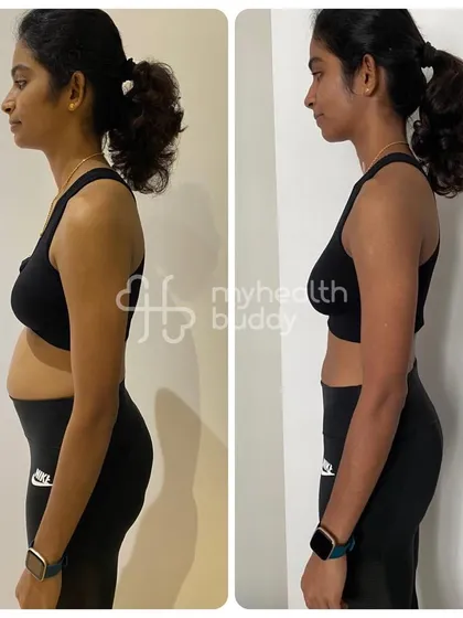 Logeswary lost 4 kgs in 3 months, but more importantly, she lost significant belly fat and gained muscle. Her side profile shows a much stronger and more defined core.
