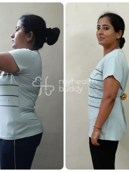 Surabhi's 15 kg weight loss journey while managing hypothyroidism. Her transformation wasn't just about the scale; she also overcame fatigue, hair fall, and irregular cycles.
