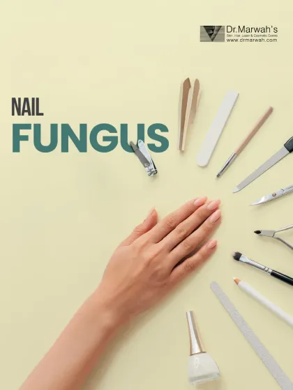 Nail fungus and other nail conditions are more than just a cosmetic issue; they can be a sign of underlying health concerns. We provide expert dermatological care to diagnose and treat these conditions effectively.